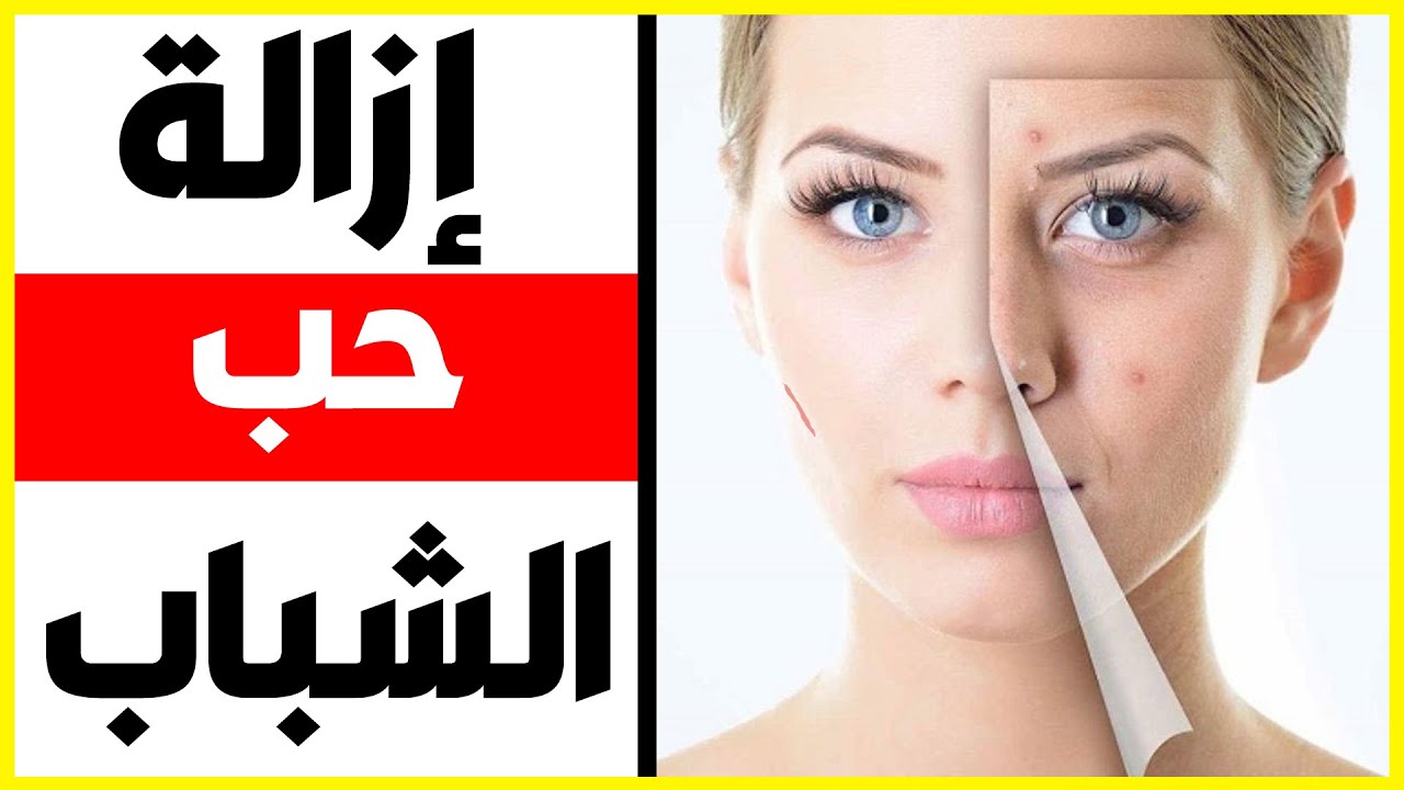 علاج اثار حب الشباب بالليزر - التخلص من البقع الناتجه عن حب الشباب 3945 3