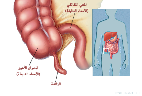 اعراض التهاب الامعاء الدقيقة - التهابات الامعاء من الامور المزعجة نتعرف على اعراضها 2865 5