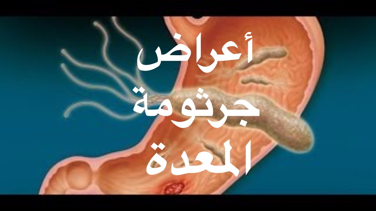 سبب جرثومة المعدة , اعراضها وطرق الوقايه منها