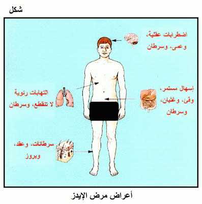 ما هو مرض Hiv - مرض الايدز اعراضه واسبابه 3175 3