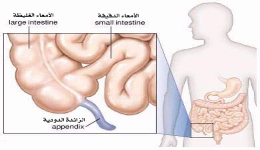 اعراض التهاب الامعاء الدقيقة - التهابات الامعاء من الامور المزعجة نتعرف على اعراضها 2865 3