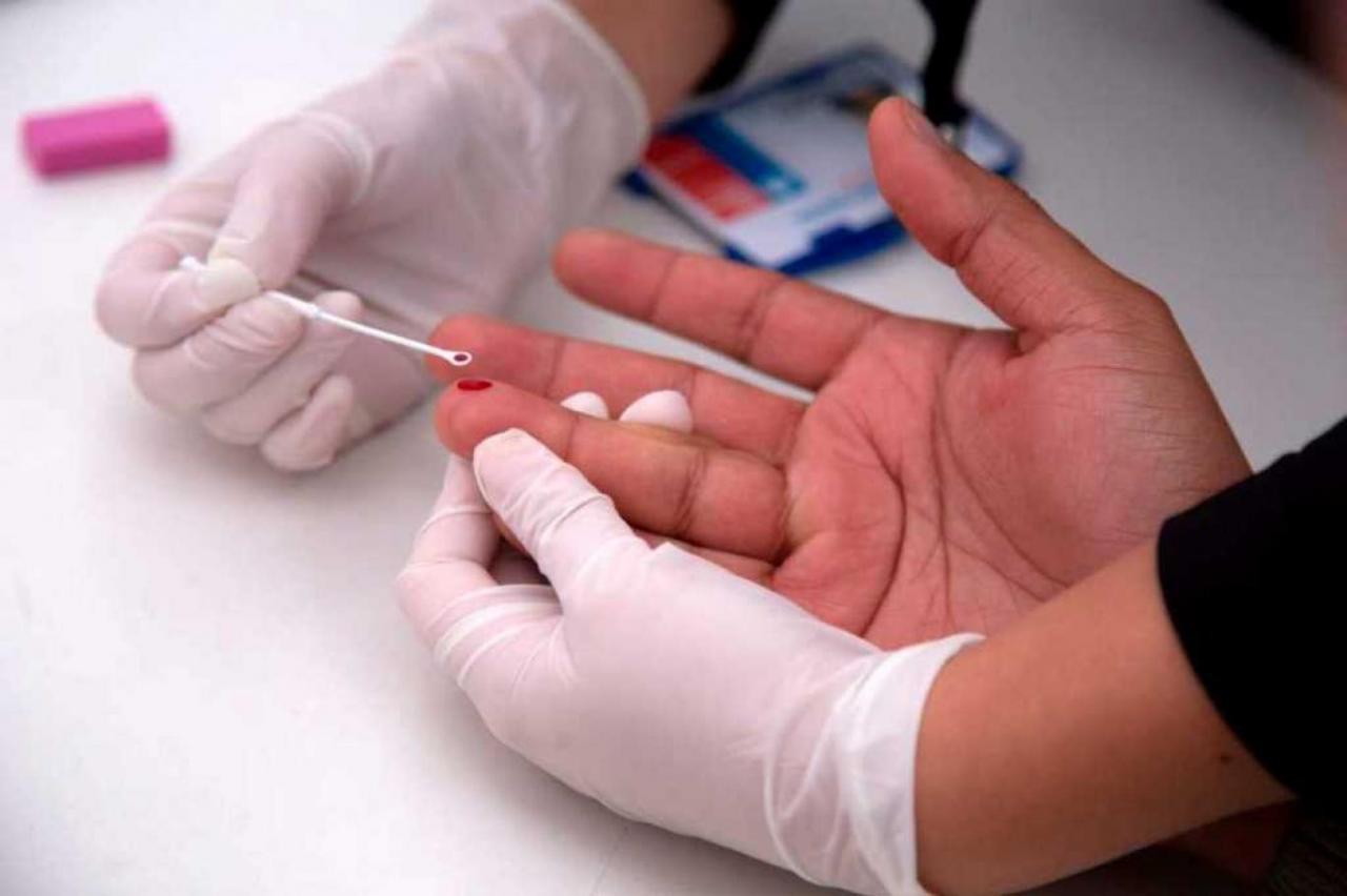 ما هو ال Hiv - معنى تحليل ال Hiv 2260 2