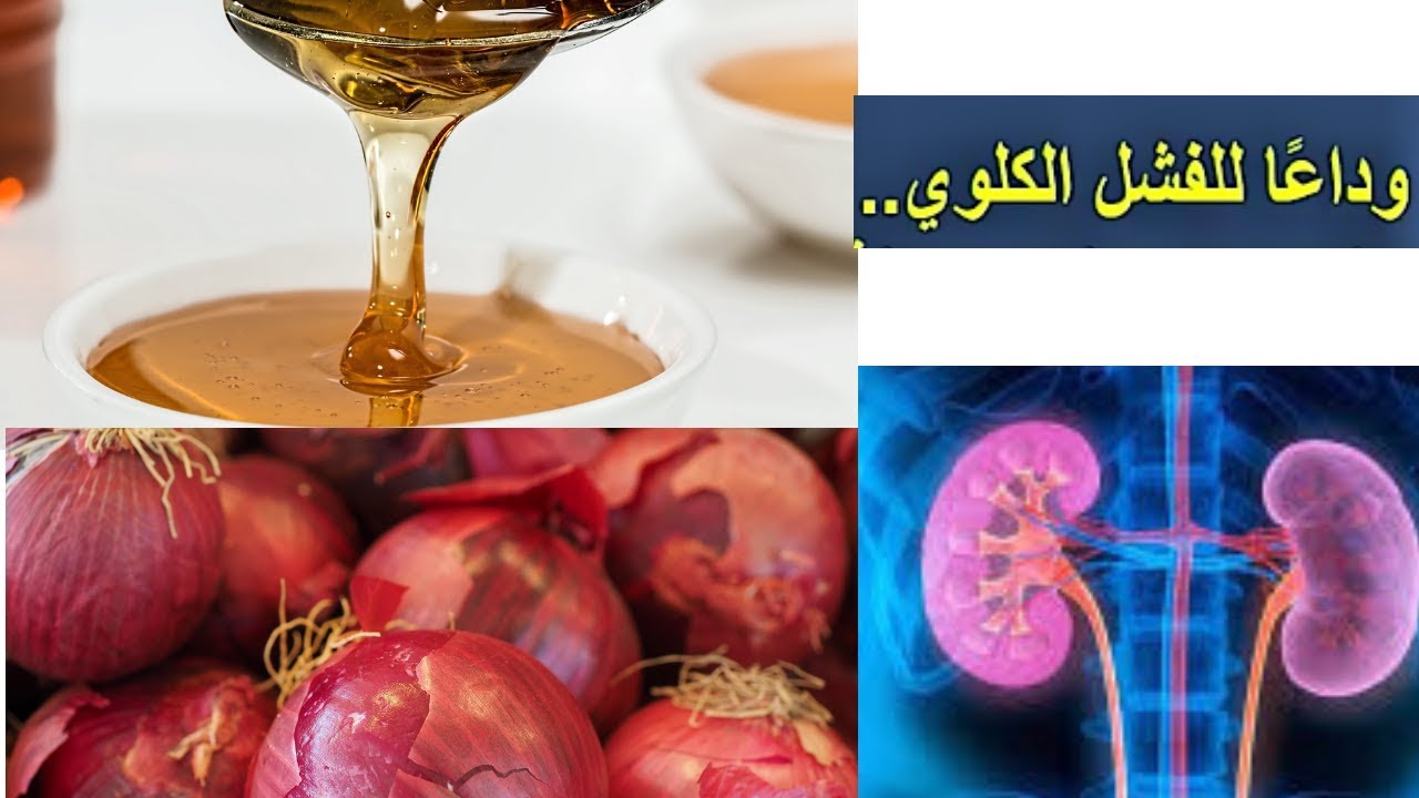 علاج الفشل الكلوي , هل هناك حل للفشل الكلوي