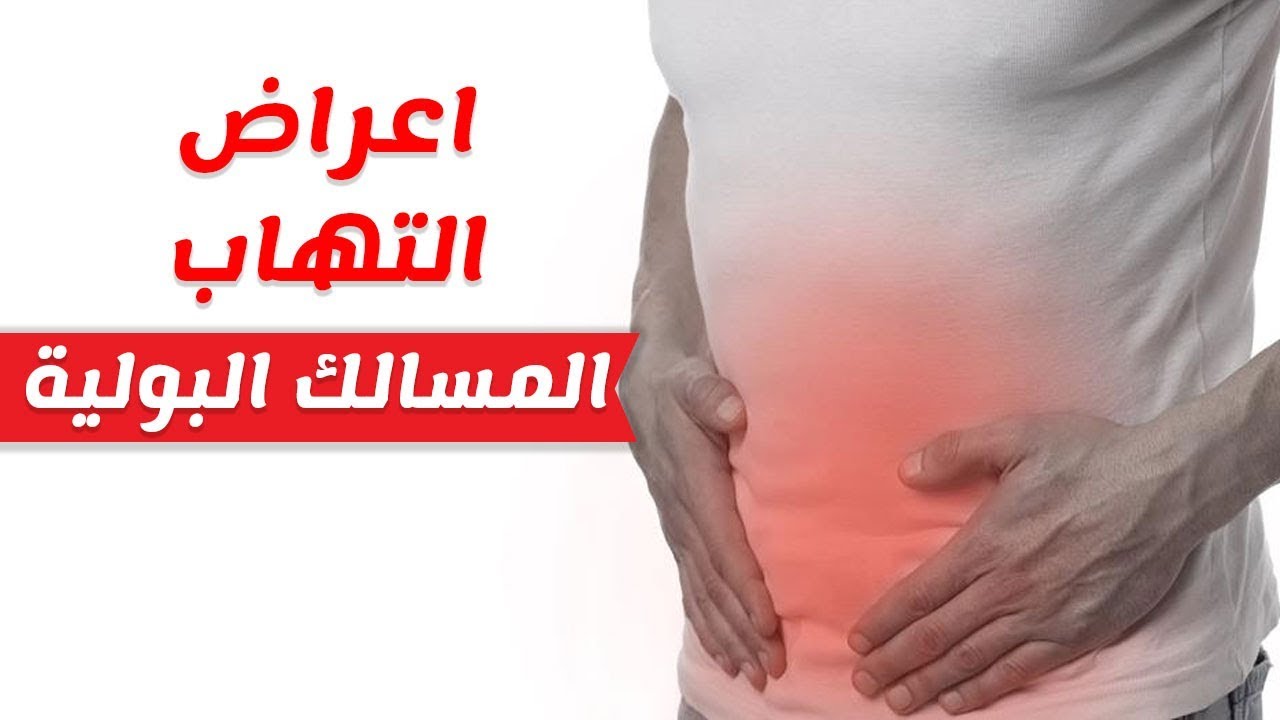 علاج حرقة البول , كيف اعالج حرقان البول