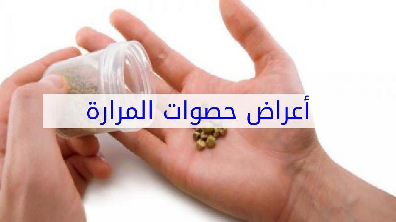 اعراض حصوة المرارة , كل ما يخص الباحث عن هذا المقال