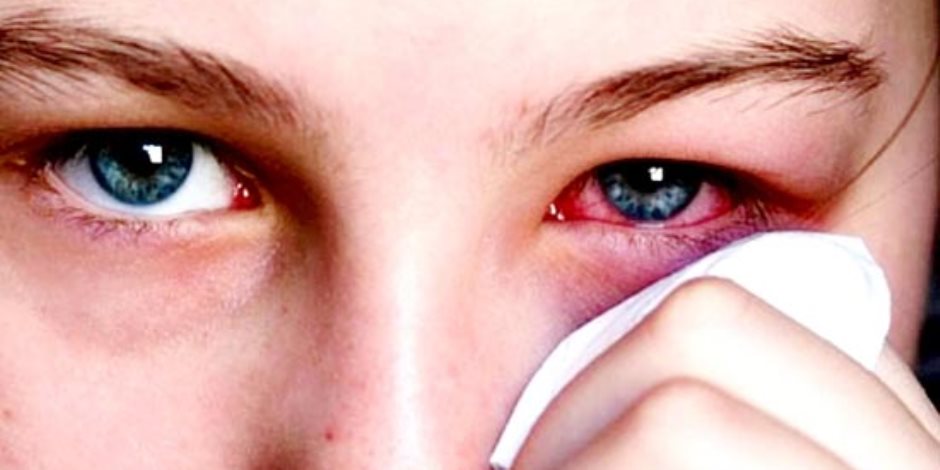 اذا لم تذهب الطبيب عندما تعاني من جفاف العين ستعاني من مضاعفات , اضرار ...